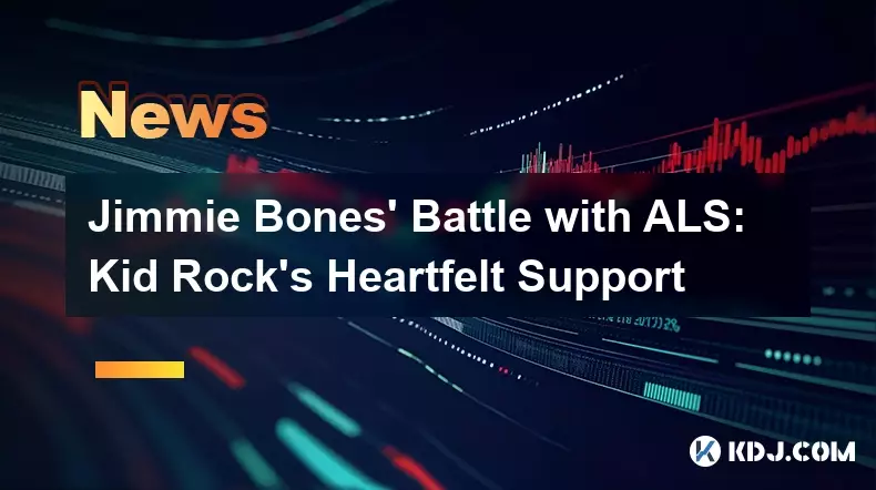 吉米·博恩斯 (Jimmie Bones) 与 ALS 的斗争:摇滚小子 (Kid Rock) 的衷心支持 吉米·博恩斯 (Jimmie Bones) 与 ALS 的斗争:摇滚小子 (Kid Rock) 的衷心支持