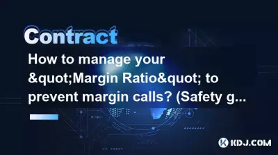 How to manage your 